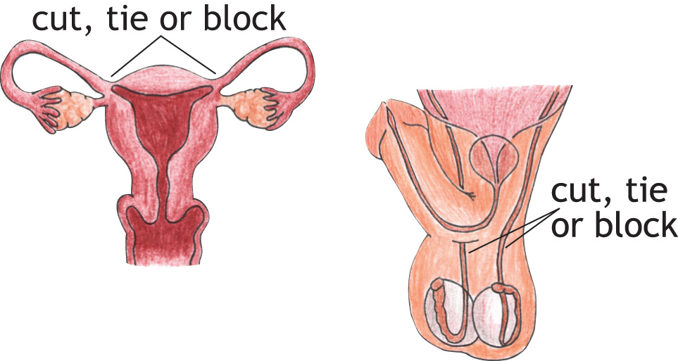 Sterilization info